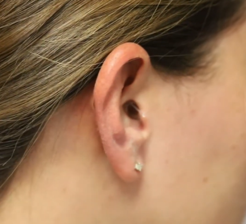 Earasers earplugs